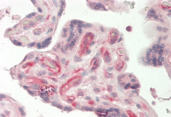 ANGPTL3 Rabbit Polyclonal Antibody