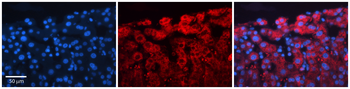 ACLY Rabbit Polyclonal Antibody