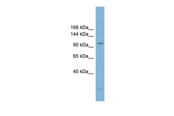 ACLY Rabbit Polyclonal Antibody