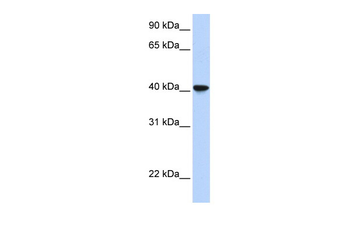 SIGLEC6 Rabbit Polyclonal Antibody