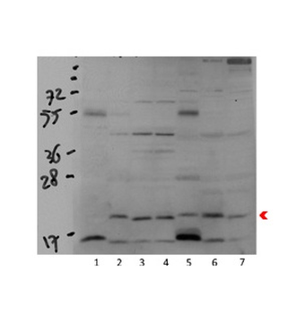 COX4I1 Rabbit Polyclonal Antibody