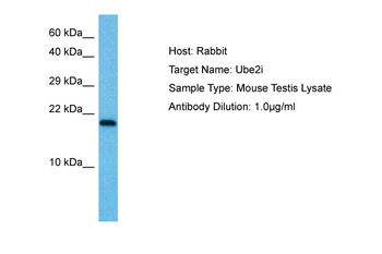UBE2I Rabbit Polyclonal Antibody