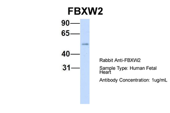 FBXW2 Rabbit Polyclonal Antibody