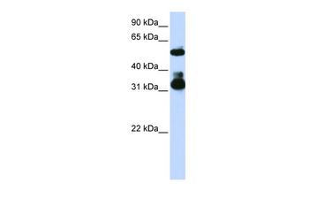 FBXW2 Rabbit Polyclonal Antibody