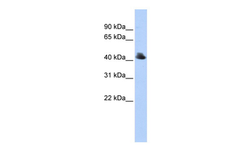 FBXO4 Rabbit Polyclonal Antibody