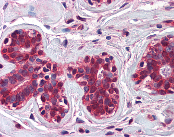 CHFR Rabbit Polyclonal Antibody