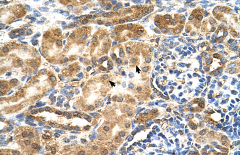 GCNT3 Rabbit Polyclonal Antibody