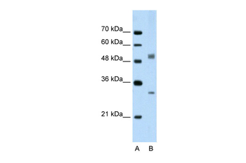 IRF6 Rabbit Polyclonal Antibody