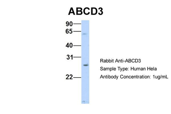 ABCD3 Rabbit Polyclonal Antibody