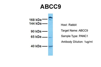 ABCC9 Rabbit Polyclonal Antibody
