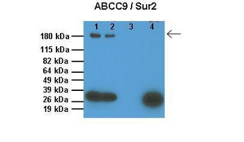 ABCC9 Rabbit Polyclonal Antibody