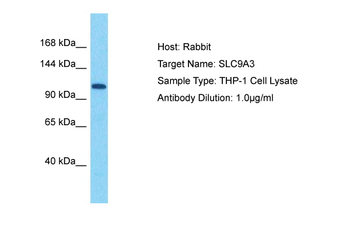 SLC9A3 Rabbit Polyclonal Antibody