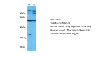 SLC25A1 Rabbit Polyclonal Antibody