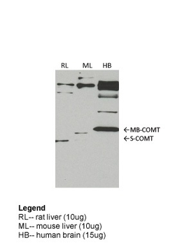 COMT Rabbit Polyclonal Antibody