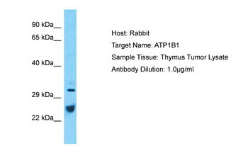 ATP1B1 Rabbit Polyclonal Antibody