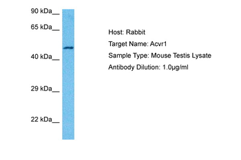 ACVR1 Rabbit Polyclonal Antibody