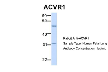 ACVR1 Rabbit Polyclonal Antibody