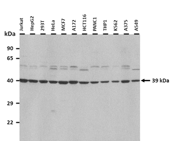 ST3GAL1 Rabbit Polyclonal Antibody