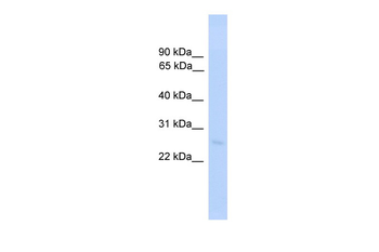 TDGF1 Rabbit Polyclonal Antibody