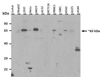 RORA Rabbit Polyclonal Antibody