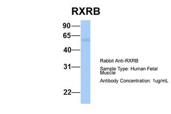 RXRB Rabbit Polyclonal Antibody