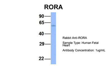 RORA Rabbit Polyclonal Antibody