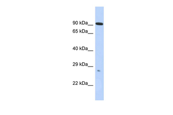 ADAM23 Rabbit Polyclonal Antibody