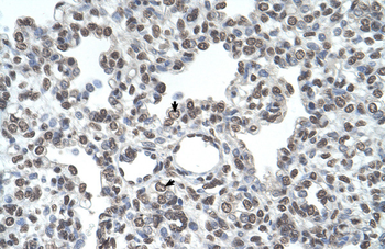 TMPRSS11D Rabbit Polyclonal Antibody