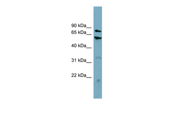 CPT1B Rabbit Polyclonal Antibody
