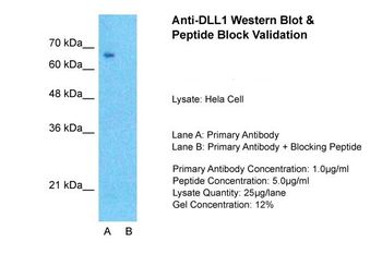 DLL1 Rabbit Polyclonal Antibody