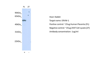 ERVW-1 Rabbit Polyclonal Antibody