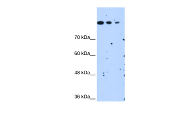 SETD2 Rabbit Polyclonal Antibody