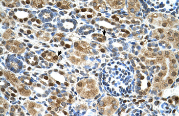 ZNF169 Rabbit Polyclonal Antibody