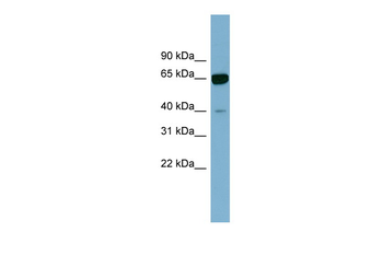 ZNF169 Rabbit Polyclonal Antibody