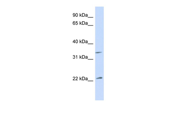ARF1 Rabbit Polyclonal Antibody