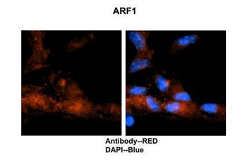 ARF1 Rabbit Polyclonal Antibody