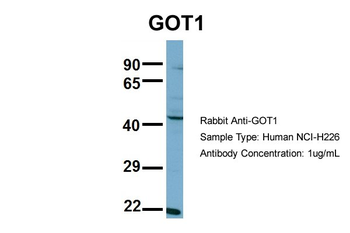 GOT1 Rabbit Polyclonal Antibody