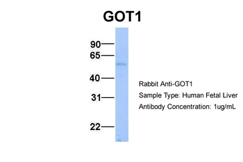 GOT1 Rabbit Polyclonal Antibody