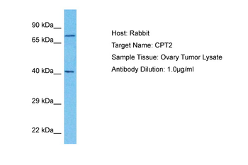 CPT2 Rabbit Polyclonal Antibody