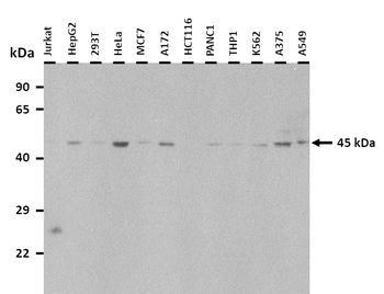 TRDMT1 Rabbit Polyclonal Antibody