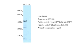 SUV39H2 Rabbit Polyclonal Antibody