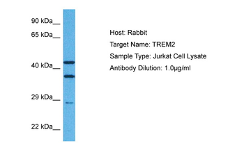 TREM2 Rabbit Polyclonal Antibody