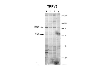 TRPV5 Rabbit Polyclonal Antibody