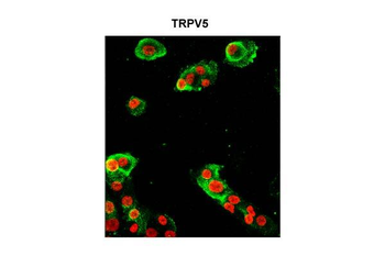 TRPV5 Rabbit Polyclonal Antibody