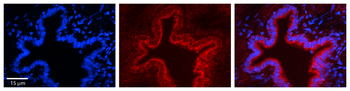 SRPRB Rabbit Polyclonal Antibody