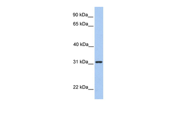 SRPRB Rabbit Polyclonal Antibody