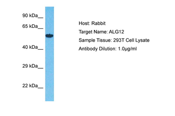 ALG12 Rabbit Polyclonal Antibody