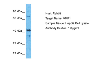 VMP1 Rabbit Polyclonal Antibody