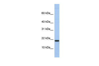 C1D Rabbit Polyclonal Antibody