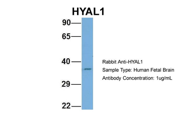 HYAL1 Rabbit Polyclonal Antibody